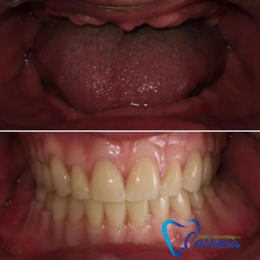 Slider image (6) Centro Odontologico Carrera